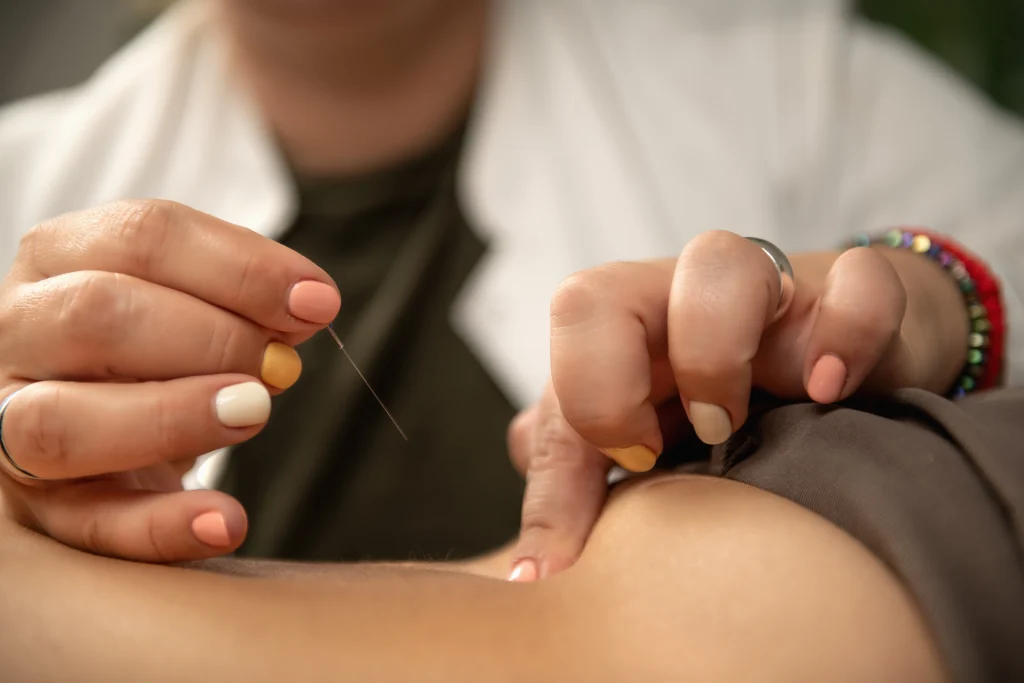 Can Acupuncture Help With Alcohol Addiction? Evidence & Best Practices Banner